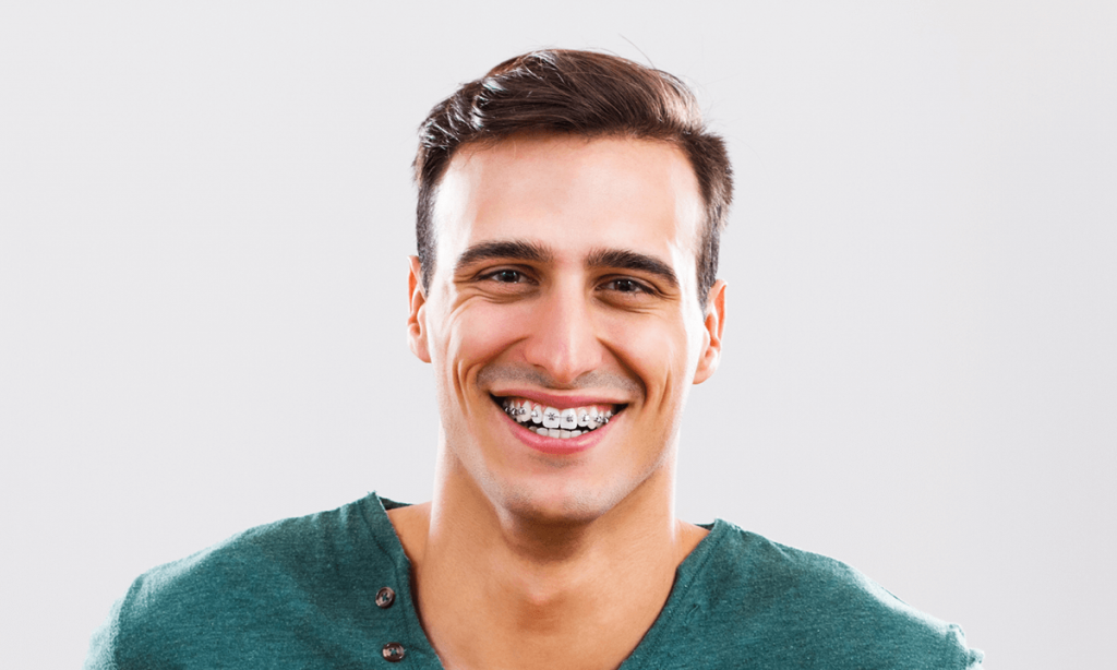 Dentiste Montreal - Soins Orthodontiques