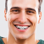 Soins Orthodontiques à Montreal